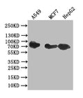 Western Blot
Positive WB detected in: A549 whole cell lysate, MCF7 whole cell lysate, HepG2 whole cell lysate
All lanes: CD44 antibody at 1:1000
Secondary
Goat polyclonal to rabbit IgG at 1/50000 dilution
Predicted band size: 81 kDa
Observed band size: 81 kDa