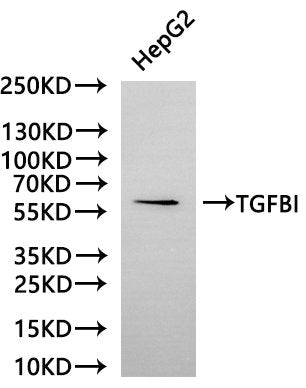 Western Blot
Positive WB detected in: HepG2 whole cell lysate(30µg)
All lanes: TGFBI antibody at 1:1000
Secondary
Goat polyclonal to rabbit IgG at 1/40000 dilution
Predicted band size: 75 kDa
Observed band size: 68 kDa
Exposure time：2min