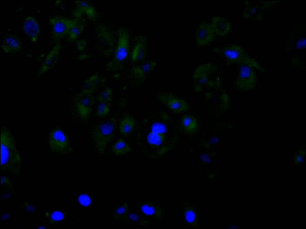 Immunofluorescence staining of Hela cell with CSB-RA293122A0HU at 1:50, counter-stained with DAPI. The cells were fixed in 4% formaldehyde and blocked in 10% normal Goat Serum. The cells were then incubated with the antibody overnight at 4°C. The secondary antibody was Alexa Fluor 488-congugated AffiniPure Goat Anti-Rabbit IgG(H+L) .