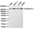 Western Blot
Positive WB detected in: Hela whole cell lysate(30µg) , K562 whole cell lysate(30µg) , HT-29 whole cell lysate(30µg) , Jurkat whole cell lysate(30µg) 
All lanes: Exportin 5 antibody at 1:1000
Secondary
Goat polyclonal to rabbit IgG at 1/40000 dilution
Predicted band size: 136 kDa
Observed band size: 136 kDa
Exposure time：2min