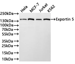 Western Blot
Positive WB detected in: Hela whole cell lysate(30µg) , K562 whole cell lysate(30µg) , HT-29 whole cell lysate(30µg) , Jurkat whole cell lysate(30µg) 
All lanes: Exportin 5 antibody at 1:1000
Secondary
Goat polyclonal to rabbit IgG at 1/40000 dilution
Predicted band size: 136 kDa
Observed band size: 136 kDa
Exposure time：2min