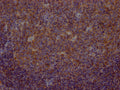 IHC image of CSB-RA294332A0HU diluted at 1:100 and staining in paraffin-embedded human tonsil tissue performed on a Leica BondTM system. After dewaxing and hydration, antigen retrieval was mediated by high pressure in a citrate buffer (pH 6.0) . Section was blocked with 10% normal goat serum 30min at RT. Then primary antibody (1% BSA) was incubated at 4℃ overnight. The primary is detected by a Goat anti-rabbit IgG polymer labeled by HRP and visualized using 0.05% DAB.
