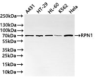 Western Blot
Positive WB detected in: A431 whole cell lysate(30µg) , HT29 whole cell lysate(30µg) , HL-60 whole cell lysate(30µg) , K562 whole cell lysate(30µg) , Hela whole cell lysate(30µg) 
All lanes: RPN1 antibody at 1:1000
Secondary
Goat polyclonal to rabbit IgG at 1/40000 dilution
Predicted band size: 69 kDa
Observed band size: 70 kDa
Exposure time：1min