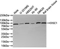 Western Blot
Positive WB detected in: Hela whole cell lysate(20µg) , U-251MG whole cell lysate(20µg) , HEK293T whole cell lysate(20µg) , HL-60 whole cell lysate(20µg) , SW620 whole cell lysate(20µg) , Rat brain tissue lysate(20µg) 
All lanes: DISC1 antibody at 1:1000
Secondary
Goat polyclonal to rabbit IgG at 1/40000 dilution
Predicted band size: 100 kDa
Observed band size: 115 kDa
Exposure time：1min