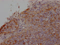 CCR2 Antibody – Figure 1 of 1