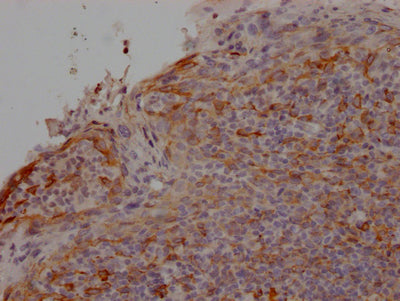 CCR2 Antibody – Figure 1 of 1