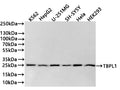 Western Blot
Positive WB detected in: K562 whole cell lysate(20µg) , HepG2 whole cell lysate(20µg) , U251MG whole cell lysate(20µg) , SH-SY5Y whole cell lysate(20µg) , Hela whole cell lysate(20µg) , 293T whole cell lysate(20µg) 
All lanes: TBPL1 antibody at 1:1000
Secondary
Goat polyclonal to rabbit IgG at 1/40000 dilution
Predicted band size: 21 kDa
Observed band size: 23 kDa
Exposure time：2min