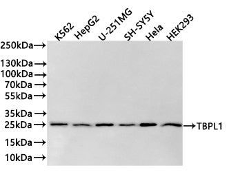 Western Blot
Positive WB detected in: K562 whole cell lysate(20µg) , HepG2 whole cell lysate(20µg) , U251MG whole cell lysate(20µg) , SH-SY5Y whole cell lysate(20µg) , Hela whole cell lysate(20µg) , 293T whole cell lysate(20µg) 
All lanes: TBPL1 antibody at 1:1000
Secondary
Goat polyclonal to rabbit IgG at 1/40000 dilution
Predicted band size: 21 kDa
Observed band size: 23 kDa
Exposure time：2min
