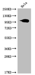 Western Blot
Positive WB detected in: Hela whole cell lysate
All lanes: ACO1 antibody at 1:2000
Secondary
Goat polyclonal to rabbit IgG at 1/50000 dilution
Predicted band size: 100 kDa
Observed band size: 95-130 kDa