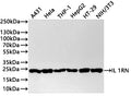 Western Blot
Positive WB detected in: A431 whole cell lysate(30µg) , Hela whole cell lysate(30µg) ,THP-1 whole cell lysate(30µg) ,HepG2 whole cell lysate(30µg) , HT-29 whole cell lysate(30µg) , NIH/3T3 whole cell lysate(30µg) , Raw264.7 whole cell lysate(30µg) 
All lanes: IL 1RN antibody at 1:1000
Secondary
Goat polyclonal to rabbit IgG at 1/40000 dilution
Predicted band size: 20 kDa
Observed band size: 22 kDa
Exposure time：20s
