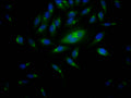 RPS6KB1 Antibody – Figure 1 of 1