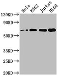 Western Blot
Positive WB detected in: Hela whole cell lysate, K562 whole cell lysate, Jurkat whole cell lysate, HL60 whole cell lysate
All lanes: HDAC1 antibody at 1:2000
Secondary
Goat polyclonal to rabbit IgG at 1/50000 dilution
Predicted band size: 56 kDa
Observed band size: 60 kDa