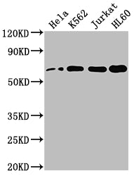 Western Blot
Positive WB detected in: Hela whole cell lysate, K562 whole cell lysate, Jurkat whole cell lysate, HL60 whole cell lysate
All lanes: HDAC1 antibody at 1:2000
Secondary
Goat polyclonal to rabbit IgG at 1/50000 dilution
Predicted band size: 56 kDa
Observed band size: 60 kDa