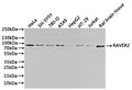 Western Blot
Positive WB detected in: Hela whole cell lysate(30µg), SH-SY5Y whole cell lysate(30µg), 780-O whole cell lysate(30µg), A549 whole cell lysate(30µg), HepG2 whole cell lysate(30µg), HT-29 whole cell lysate(30µg), Jurkat whole cell lysate(30µg), Raw264.7 whole cell lysate(30µg)
All lanes: RAVER2 antibody at 1:1000
Secondary
Goat polyclonal to rabbit IgG at 1/40000 dilution
Predicted band size: 74 kDa
Observed band size: 85 kDa
Exposure time：1min