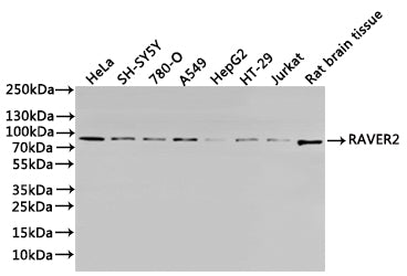 Western Blot
Positive WB detected in: Hela whole cell lysate(30µg), SH-SY5Y whole cell lysate(30µg), 780-O whole cell lysate(30µg), A549 whole cell lysate(30µg), HepG2 whole cell lysate(30µg), HT-29 whole cell lysate(30µg), Jurkat whole cell lysate(30µg), Raw264.7 whole cell lysate(30µg)
All lanes: RAVER2 antibody at 1:1000
Secondary
Goat polyclonal to rabbit IgG at 1/40000 dilution
Predicted band size: 74 kDa
Observed band size: 85 kDa
Exposure time：1min