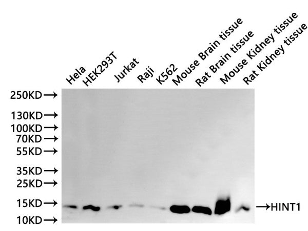 Western Blot
Positive WB detected in: Hela whole cell lysate(30µg), HEK293T whole cell lysate(30µg), Jurkat whole cell lysate(30µg), Raji whole cell lysate(30µg), K562 whole cell lysate(30µg), Mouse brain tissue lysate(30µg), Rat brain tissue lysate(30µg), Mouse kidney tissue lysate(30µg), Rat kidney tissue lysate(30µg)
All lanes: HINT1 antibody at 1:1000
Secondary
Goat polyclonal to rabbit IgG at 1/40000 dilution
Predicted band size: 14 kDa
Observed band size: 14 kDa
Exposure time：2min