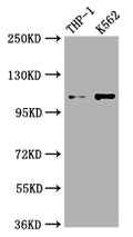 Western Blot
Positive WB detected in: THP-1 whole cell lysate, K562 whole cell lysate
All lanes: C3 antibody at 1:1000
Secondary
Goat polyclonal to rabbit IgG at 1/50000 dilution
Predicted band size: 188 kDa
Observed band size: 115 kDa