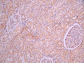 IHC image of CSB-RA310122A0HU diluted at 1:100 and staining in paraffin-embedded human kidney tissue performed on a Leica BondTM system. After dewaxing and hydration, antigen retrieval was mediated by high pressure in a citrate buffer (pH 6.0). Section was blocked with 10% normal goat serum 30min at RT. Then primary antibody (1% BSA) was incubated at 4°C overnight. The primary is detected by a Goat anti-rabbit polymer IgG labeled by HRP and visualized using 0.05% DAB.