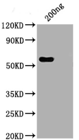 Western Blot Positive WB detected in: His tag-tagged SARS-CoV-2 nucleocapsid recombinant protein from E. Coli (CSB-EP3325GMY)  SARS-CoV-2 nucleocapsid antibody at 1:1000 (CSB-RA33255A1GMY)  Secondary Peroxidase-Affinipure Goat Anti-Human IgG Fc Fragment Specific at 1/20000 dilution Predicted band size: 48 kDa Observed band size: 55 kDa