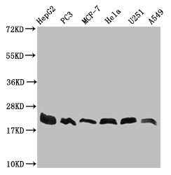 Western Blot
Positive WB detected in: HepG2 whole cell lysate, PC3 whole cell lysate, MCF-7 whole cell lysate, Hela whole cell lysate, U251 whole cell lysate, A549 whole cell lysate
All lanes: FIS1 antibody at 1:1000
Secondary
Goat polyclonal to rabbit IgG at 1/50000 dilution
Predicted band size: 17 kDa
Observed band size: 17-22 kDa