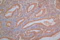 PRDX2 Recombinant Monoclonal Antibody – Figure 1 of 2