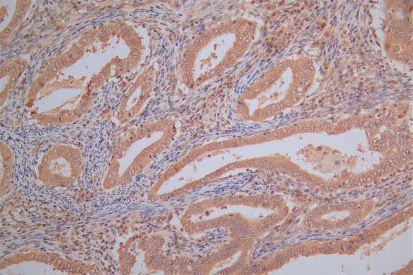 PRDX2 Recombinant Monoclonal Antibody – Figure 1 of 2