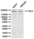 Western Blot
Positive WB detected in: MCF-7 whole cell lysate(30µg), HEK293 whole cell lysate(30µg)
All lanes: TSC2 antibody at 1:1000
Secondary
Goat polyclonal to human IgG at 1/40000 dilution
Predicted band size: 200 kDa
Observed band size: 200 kDa
Exposure time: 180s