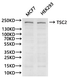 Western Blot
Positive WB detected in: MCF-7 whole cell lysate(30µg), HEK293 whole cell lysate(30µg)
All lanes: TSC2 antibody at 1:1000
Secondary
Goat polyclonal to human IgG at 1/40000 dilution
Predicted band size: 200 kDa
Observed band size: 200 kDa
Exposure time: 180s