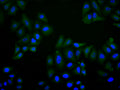 Immunofluorescence staining of Hela cell with CSB-RA351810MA1HU at 1:30 ,counter-stained with DAPI. The cells were fixed in 4% formaldehyde, permeabilized using 0.2% Triton X-100 and blocked in 10% normal Goat Serum. The cells were then incubated with the antibody overnight at 4°C. The secondary antibody was Alexa Fluor 488-congugated AffiniPure Goat Anti-Human IgG(H+L) .