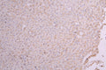 IHC image of CSB-RA356436MA1HU diluted at 1:100 and staining in paraffin-embedded human liver tissue performed on a Leica BondTM system. After dewaxing and hydration, antigen retrieval was mediated by high pressure in a citrate buffer (pH 6.0) . Section was blocked with 10% normal goat serum 30min at RT. Then primary antibody (1% BSA) was incubated at 4°C overnight. The primary is detected by a Goat anti-Human IgG labeled by HRP and visualized using 0.05% DAB.
