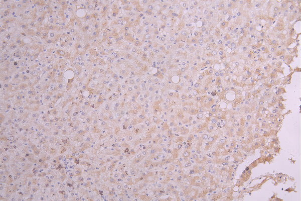 IHC image of CSB-RA356436MA1HU diluted at 1:100 and staining in paraffin-embedded human liver tissue performed on a Leica BondTM system. After dewaxing and hydration, antigen retrieval was mediated by high pressure in a citrate buffer (pH 6.0) . Section was blocked with 10% normal goat serum 30min at RT. Then primary antibody (1% BSA) was incubated at 4°C overnight. The primary is detected by a Goat anti-Human IgG labeled by HRP and visualized using 0.05% DAB.