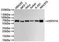 Western Blot
Positive WB detected in: HEK293 whole cell lysate(30µg) , MCF-7 whole cell lysate(30µg) , Hela whole cell lysate(30µg) , Jurkat whole cell lysate(30µg) , A-431 whole cell lysate(30µg) , NIH/3T3 whole cell lysate(30µg) 
All lanes: HSPA1A antibody at 1:1000
Secondary
Goat polyclonal to human IgG at 1/40000 dilution
Predicted band size: 70 kDa
Observed band size: 70 kDa
Exposure time: 2min