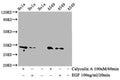 Western Blot
Positive WB detected in Hela whole cell lysate,A549 whole cell lysate(treated with Calyculin A or EGF) 
All lanes Phospho-CDK1/CDK2/CDK3 antibody at 0.76μg/ml
Secondary
Goat polyclonal to rabbit IgG at 1/50000 dilution
Predicted band size: 34 KDa
Observed band size: 34 KDa