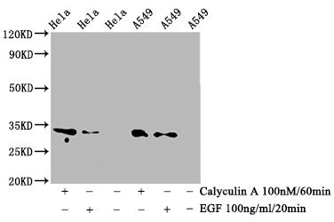 Western Blot
Positive WB detected in Hela whole cell lysate,A549 whole cell lysate(treated with Calyculin A or EGF) 
All lanes Phospho-CDK1/CDK2/CDK3 antibody at 0.76μg/ml
Secondary
Goat polyclonal to rabbit IgG at 1/50000 dilution
Predicted band size: 34 KDa
Observed band size: 34 KDa