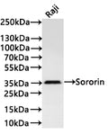 Western Blot
Positive WB detected in:Raji whole cell lysate(30µg) 
All lanes: Sororin antibody at 1:1000
Secondary
Goat polyclonal to rabbit IgG at 1/40000 dilution
Predicted band size: 28 kDa
Observed band size: 35 kDa
Exposure time：3min
