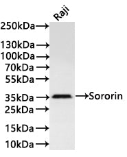 Western Blot
Positive WB detected in:Raji whole cell lysate(30µg) 
All lanes: Sororin antibody at 1:1000
Secondary
Goat polyclonal to rabbit IgG at 1/40000 dilution
Predicted band size: 28 kDa
Observed band size: 35 kDa
Exposure time：3min