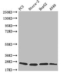Western Blot
Positive WB detected in: PC3 whole cell lysate, Ntera-2 whole cell lysate, HepG2 whole cell lysate, A549 whole cell lysate
All lanes: PRDX3 antibody at 1:2000
Secondary
Goat polyclonal to rabbit IgG at 1/50000 dilution
Predicted band size: 28, 26 kDa
Observed band size: 20-28 kDa