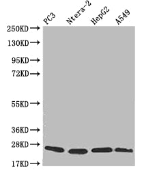 Western Blot
Positive WB detected in: PC3 whole cell lysate, Ntera-2 whole cell lysate, HepG2 whole cell lysate, A549 whole cell lysate
All lanes: PRDX3 antibody at 1:2000
Secondary
Goat polyclonal to rabbit IgG at 1/50000 dilution
Predicted band size: 28, 26 kDa
Observed band size: 20-28 kDa