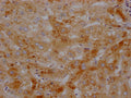 IHC image of CSB-RA437590A0HU diluted at 1:100 and staining in paraffin-embedded human liver tissue performed on a Leica BondTM system. After dewaxing and hydration, antigen retrieval was mediated by high pressure in a citrate buffer (pH 6.0) . Section was blocked with 10% normal goat serum 30min at RT. Then primary antibody (1% BSA) was incubated at 4℃ overnight. The primary is detected by a Goat anti-rabbit IgG polymer labeled by HRP and visualized using 0.05% DAB.