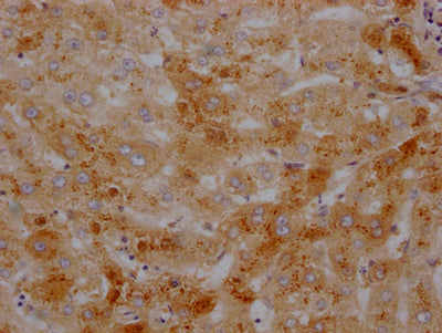 IHC image of CSB-RA437590A0HU diluted at 1:100 and staining in paraffin-embedded human liver tissue performed on a Leica BondTM system. After dewaxing and hydration, antigen retrieval was mediated by high pressure in a citrate buffer (pH 6.0) . Section was blocked with 10% normal goat serum 30min at RT. Then primary antibody (1% BSA) was incubated at 4℃ overnight. The primary is detected by a Goat anti-rabbit IgG polymer labeled by HRP and visualized using 0.05% DAB.
