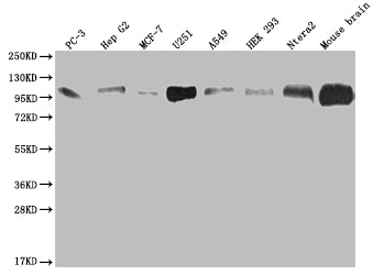 Western Blot
Positive WB detected in: PC3 whole cell lysate, HepG2 whole cell lysate, MCF-7 whole cell lysate, U251 whole cell lysate, A549 whole cell lysate, HEK293 whole cell lysate, Ntera-2 whole cell lysate, Mouse brain tissue
All lanes: ALCAM antibody at 1:2000
Secondary
Goat polyclonal to rabbit IgG at 1/50000 dilution
Predicted band size: 66, 64, 16, 34 kDa
Observed band size: 100 kDa
