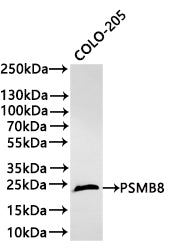 Western Blot
Positive WB detected in: COLO-205 whole cell lysate(30µg) 
All lanes: PSMB8 antibody at 1:1000
Secondary
Goat polyclonal to rabbit IgG at 1/40000 dilution
Predicted band size: 30 kDa
Observed band size: 23 kDa
Exposure time：1min40s