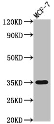 Western Blot
Positive WB detected in: MCF-7 whole cell lysate
All lanes: EPCAM antibody at 1:2000
Secondary
Goat polyclonal to rabbit IgG at 1/50000 dilution
Predicted band size: 35 kDa
Observed band size: 35 kDa