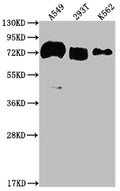 Western Blot
Positive WB detected in: A549 whole cell lysate, 293T whole cell lysate, K562 whole cell lysate
All lanes: CD55 antibody at 1:2000
Secondary
Goat polyclonal to rabbit IgG at 1/50000 dilution
Predicted band size: 42, 49, 40, 57, 60 kDa
Observed band size: 70 kDa