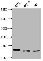 Western Blot
Positive WB detected in: U251 whole cell lysate, MCF-7 whole cell lysate, U87 whole cell lysate
All lanes: TNFRSF12A antibody at 1:2000
Secondary
Goat polyclonal to rabbit IgG at 1/50000 dilution
Predicted band size: 14, 11 kD
Observed band size: 14 kDa