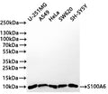 Western Blot
Positive WB detected in: U-251MG whole cell lysate(30µg) , A549 whole cell lysate, HeLa whole cell lysate(30µg) , SW620 whole cell lysate(30µg) , SH-SY5Y whole cell lysate(30µg) 
All lanes: S100A6 antibody at 1:1000
Secondary
Goat polyclonal to rabbit IgG at 1/50000 dilution
Predicted band size: 10 kDa
Observed band size: 10 kDa
Exposure time: 1min