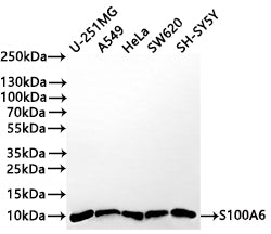 Western Blot
Positive WB detected in: U-251MG whole cell lysate(30µg) , A549 whole cell lysate, HeLa whole cell lysate(30µg) , SW620 whole cell lysate(30µg) , SH-SY5Y whole cell lysate(30µg) 
All lanes: S100A6 antibody at 1:1000
Secondary
Goat polyclonal to rabbit IgG at 1/50000 dilution
Predicted band size: 10 kDa
Observed band size: 10 kDa
Exposure time: 1min