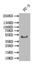 Western Blot
Positive WB detected in: PC-3 whole cell lysate
All lanes: DDB2 antibody at 1:1000
Secondary
Goat polyclonal to rabbit IgG at 1/50000 dilution
Predicted band size: 47 kDa
Observed band size: 47 kDa