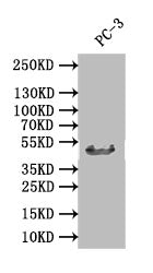 Western Blot
Positive WB detected in: PC-3 whole cell lysate
All lanes: DDB2 antibody at 1:1000
Secondary
Goat polyclonal to rabbit IgG at 1/50000 dilution
Predicted band size: 47 kDa
Observed band size: 47 kDa