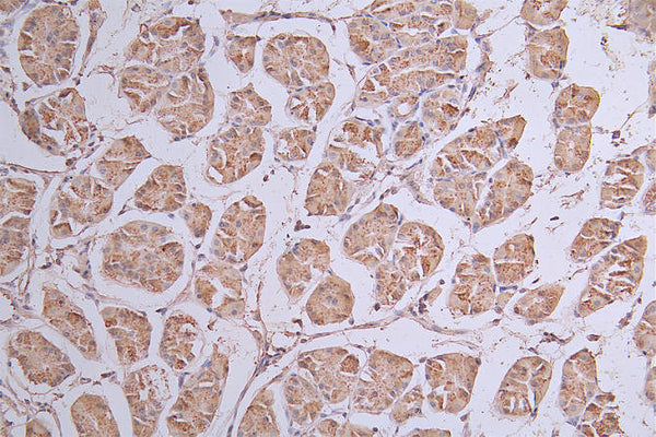 IHC image of CSB-RA443117A0HU diluted at 1:50 and staining in paraffin-embedded human stomach tissue performed on a Leica BondTM system. After dewaxing and hydration, antigen retrieval was mediated by high pressure in a citrate buffer (pH 6.0) . Section was blocked with 10% normal goat serum 30min at RT. Then primary antibody (1% BSA) was incubated at 4°C overnight. The primary is detected by a Goat anti-rabbit polymer IgG labeled by HRP and visualized using 0.13% DAB.